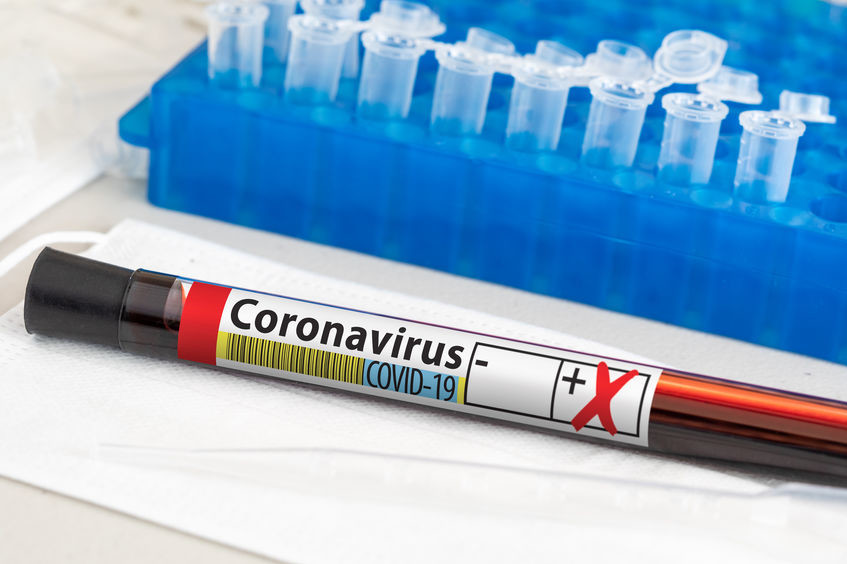 SA records 1,006 COVID-19 infections and death toll rises to 51,326