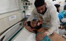 An Afghan victim receives treatments at a hospital following a suicide attack in Jalalabad. Picture: AFP.