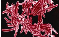 A digitally colourised scanning electron microscopic image depicts a grouping of red-coloured, rod-shaped Mycobacterium tuberculosis bacteria which cause tuberculosis in human beings. Picture: National Institute of Allergy and Infectious Diseases.