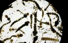 View taken through a microscope shows larvae of the mosquito Aedes Aegypti, which transmits the Zika virus, at a laboratory in Costa Rica, in January 2016. Picture: EPA/Jeffrey Arguedas.