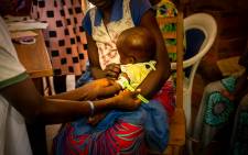 A health worker measures the circumference of a child's arm to see if the child is malnourished at a health centre in Paoua on 3 December 2021. Picture: AFP