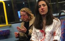 Melania Geymonat, 28, said she and her girlfriend, Chris, were left covered in blood after the attack last week. Picture: Melania Geymonat/Facebook