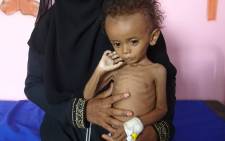 A Yemeni mother holds her malnourished child as they wait for treatments in a medical centre in the village of Al Mutaynah, in the Tuhayta province, western Yemen, in November 2018. Picture: AFP.
