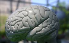 FILE: People with a gene, APOE, that’s associated with Alzheimer’s disease, were twice as likely to develop dementia as individuals without this gene, a study showed. Picture: freeimages.com.