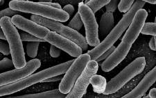A microscopic image of Escherichia coli (E. coli) bacteria. Picture: Wikimedia Commons.