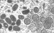 FILE: Over the past few days, several European and North American countries including Britain, France and the United States have reported cases of the rare virus which is endemic in parts of Africa. Picture: CDC/Cynthia S. Goldsmith