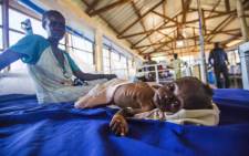 FILE: A two-month-old girl with a severe malnutrition lays on a bed next to her mother at the Aweil State Hospital, in Aweil, Northern Bahr El-Gazhal, South Sudan. Picture: AFP