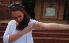 FILE: Lana Stander claims she was assaulted at a Johannesburg police station on 14 February 2015. Picture: Vumani Mkhize/EWN.