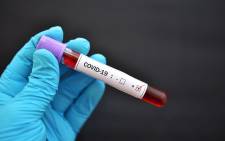 FILE: At least 169 people have recovered from COVID-19 on the continent as countries ramp up their defences and their capacity to test for the virus. Picture: 123rf.