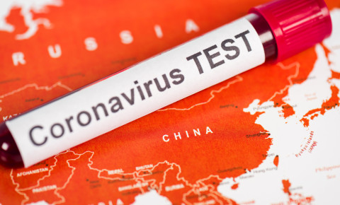 China coronavirus test Covid-19 123rf