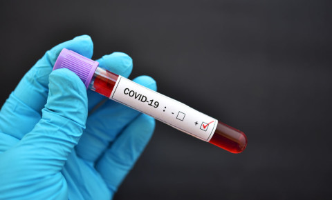 COVID-19 virus coronavirus outbreak blood sample test tube 123rfpolitics 123rf