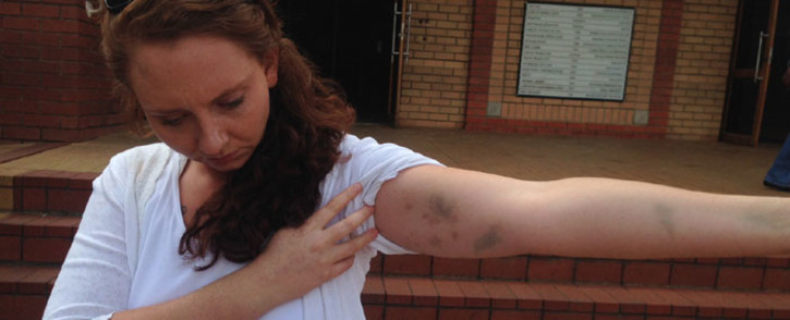 Lana Stander claims she was assaulted at a Johannesburg police station on 14 February 2015. Picture: Vumani Mkhize/EWN