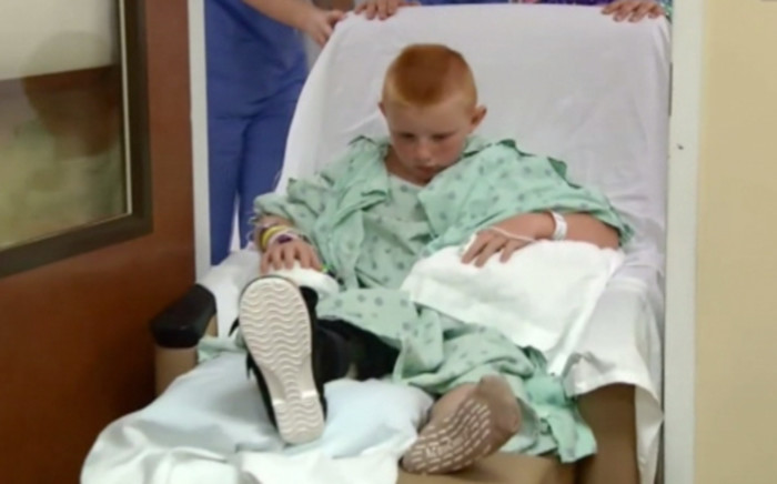 A 12-year-old boy is recovering after being bitten by a shark in Florida. Picture: Screengrab/CNN