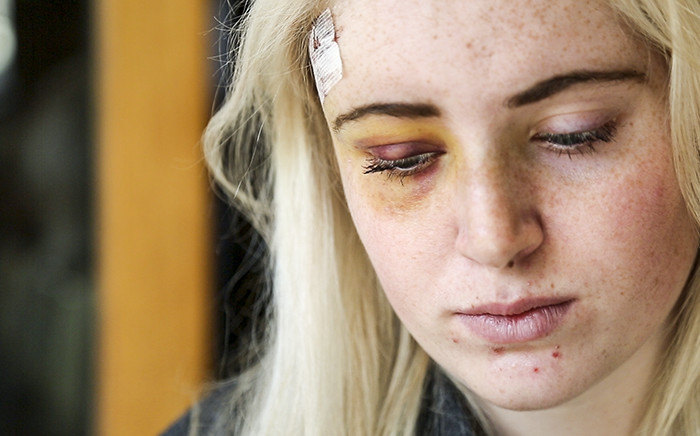 Sanet de Lange survived an attack, allegedly by a taxi driver, after leaving Tiger Tiger in Claremont, Cape Town, on 9 July 2015. Picture: Aletta Gardner/EWN.