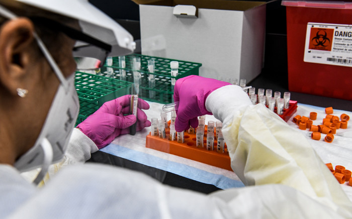 FILE: A lab technician sorts blood samples inside a lab for a COVID-19 vaccine study. Picture: AFP.