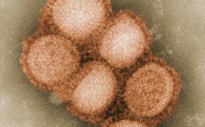 Swine flu: The H1N1 virus. Picture: Gallo Images/AFP