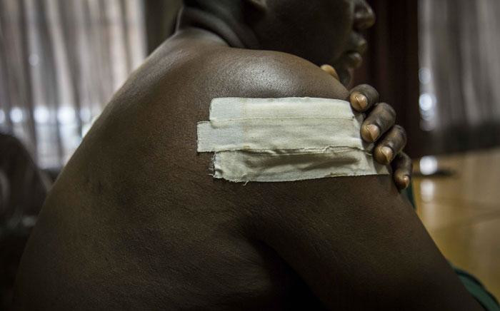 A deaf and dumb man was shot during the 1 August military shootings in Harare, Zimbabwe. He has a gunshot wound to the upper torso, the bullet is still inside his chest and needs a specialist to remove it. Picture: Thomas Holder/EWN