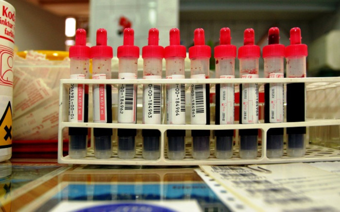 Blood test samples. Picture: Freeimages.com