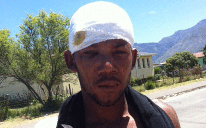 John Saaiman says he was attacked by Swellendam protesters on his way to a party on 15 November 2012. Picture: Malungelo Booi/EWN
