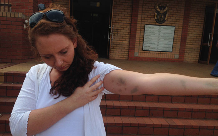 Lana Stander claims she was assaulted at a Johannesburg police station on 14 February 2015. Picture: Vumani Mkhize/EWN