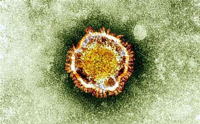 This undated handout picture courtesy of the British Health Protection Agency shows the coronavirus seen under an electron microscope. Picture: AFP.