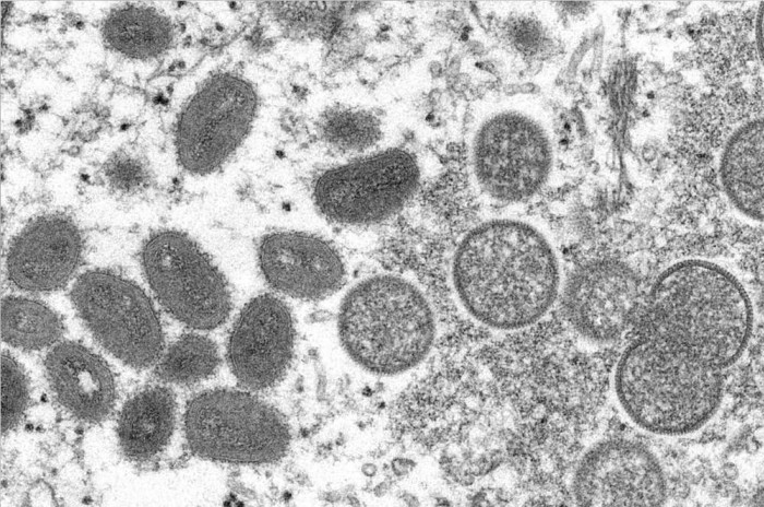Monkeypox belongs to the Poxviridae family of viruses, which includes smallpox. Picture: CDC/Cynthia S. Goldsmith